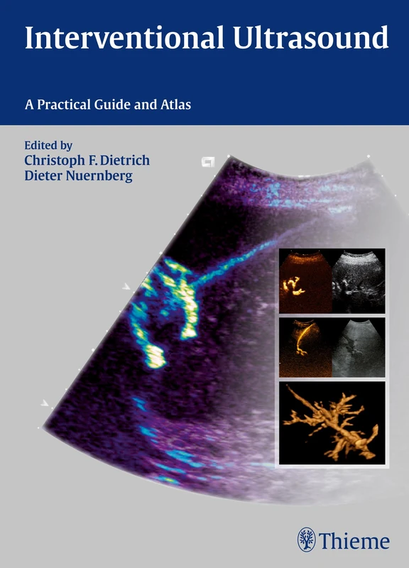 Interventional Ultrasound: Practical Guide and Atlas