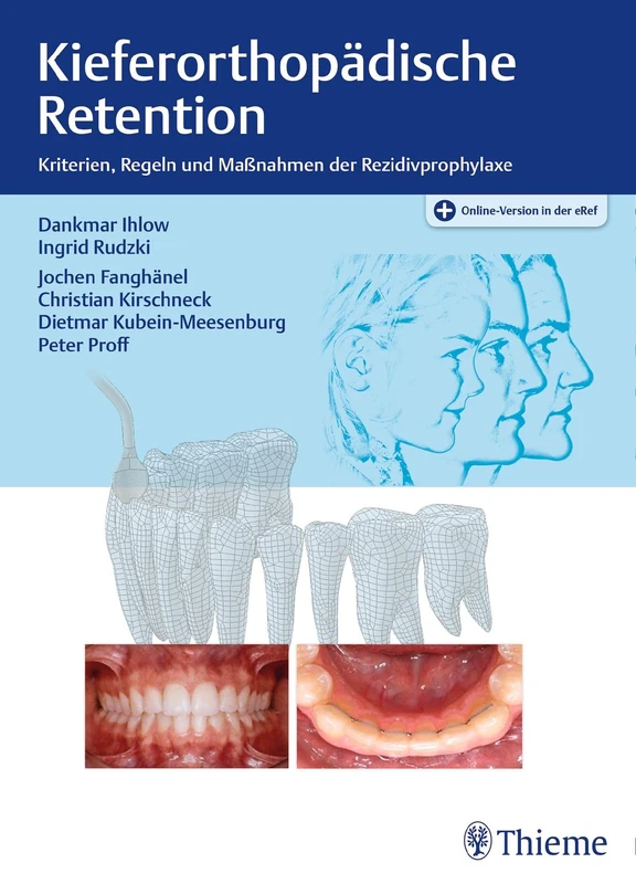Thieme Kieferorthopaedische Retention - Rezidivprophylaxe Book