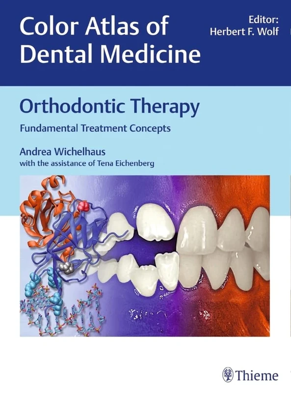 Orthodontic Therapy: Fundamental Treatment Concepts (Color Atlas Dent Med)