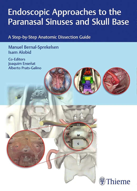 Endoscopic Approaches to the Paranasal Sinuses and Skull Base: A Step-by-Step Anatomic Dissection Guide