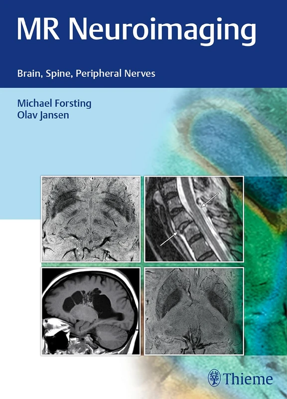 MR Neuroimaging: Brain, Spine, and Peripheral Nerves