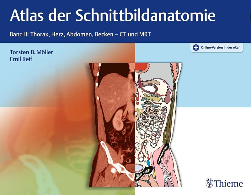 Atlas der Schnittbildanatomie: Band II: Thorax, Herz, Abdomen, Becken