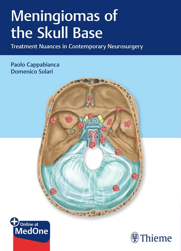 Thieme Meningiomas of the Skull Base - Neurosurgery Textbook