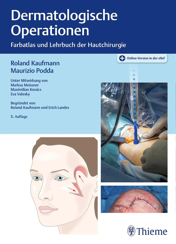 Thieme Dermatologische Operationen - Farbatlas und Lehrbuch