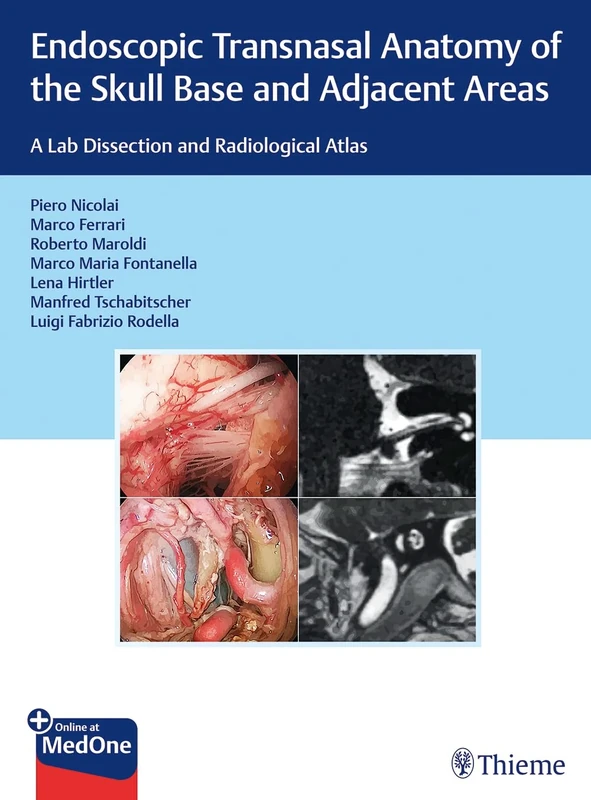 Endoscopic Transnasal Anatomy of the Skull Base and Adjacent Areas: A Lab Dissection and Radiological Atlas - Image 1