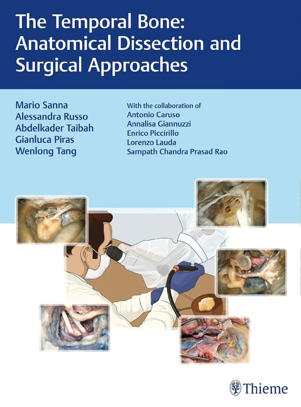 The Temporal Bone: Anatomical Dissection and Surgical Approaches