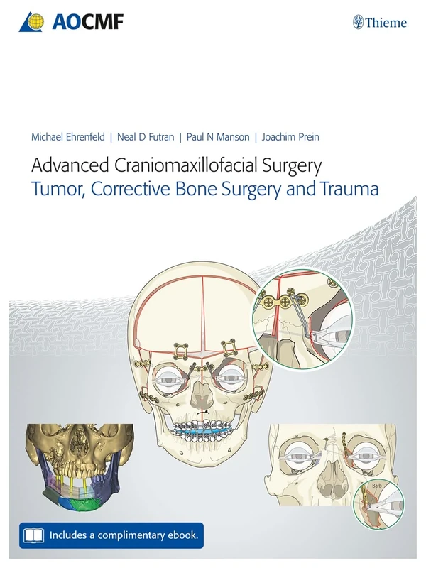 Advanced Craniomaxillofacial Surgery: Tumor, Corrective Bone Surgery, and Trauma
