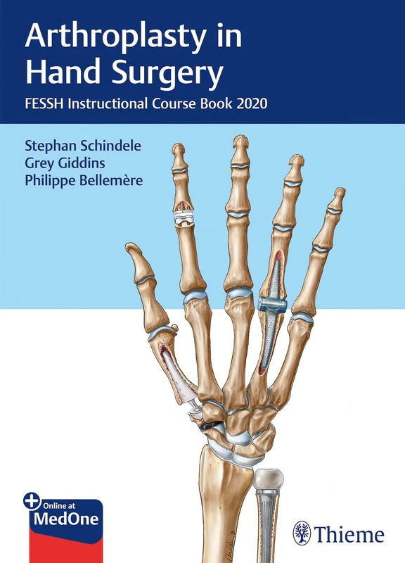 Thieme Arthroplasty in Hand Surgery - FESSH Course Book 2020