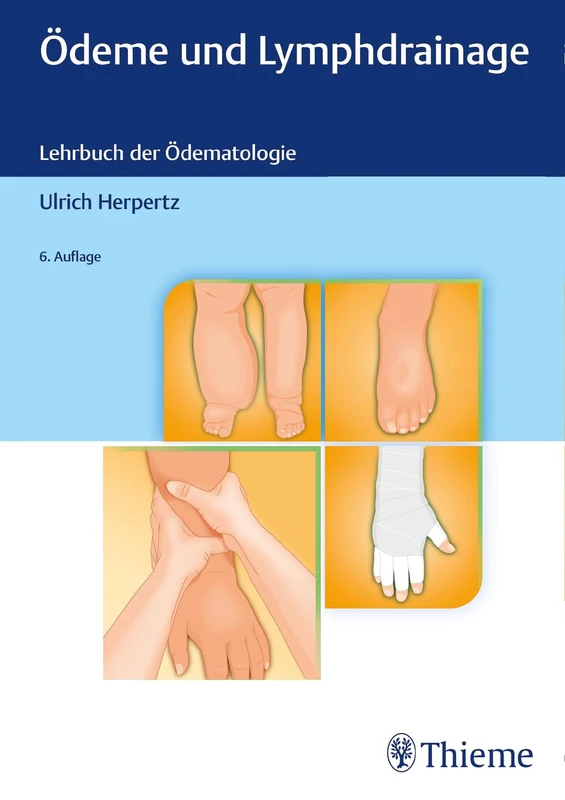 Ödeme und Lymphdrainage: Diagnose und Therapie