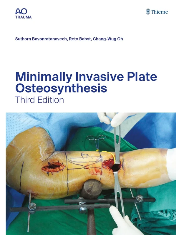 Minimally Invasive Plate Osteosynthesis (Ao-Publishing)