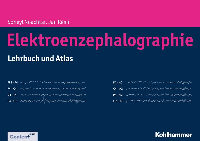Elektroenzephalographie: Lehrbuch Und Atlas