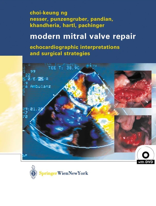 Springer Modern Mitral Valve Repair - Medical Atlas