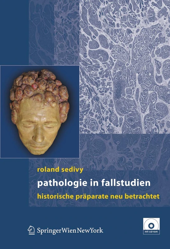 Pathologie in Fallstudien: Historische Präparate neu betrachtet - Image 1