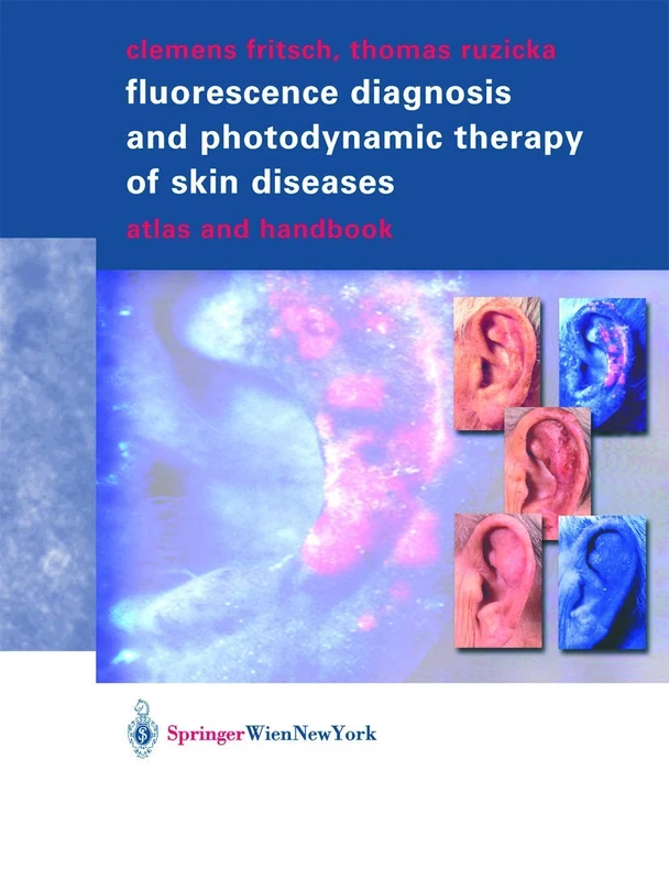 Fluorescence Diagnosis and Photodynamic Therapy of Skin Diseases: Atlas and Handbook