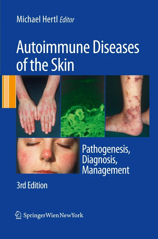 Autoimmune Diseases of the Skin: Pathogenesis, Diagnosis, Management - Image 1