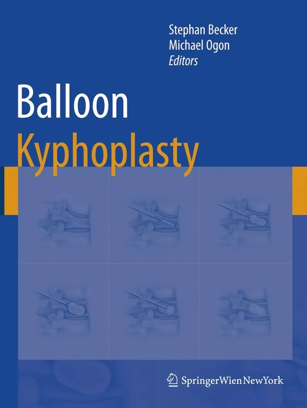 Balloon Kyphoplasty - Image 1