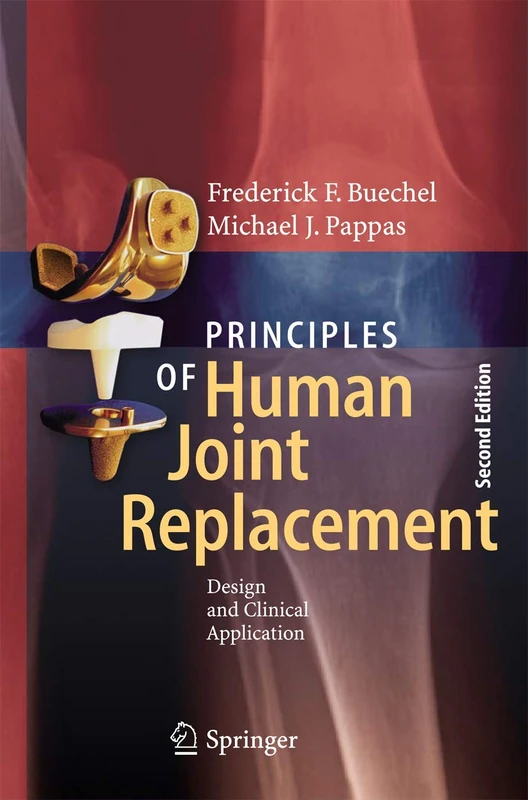 Springer Principles of Human Joint Replacement - 2nd Edition