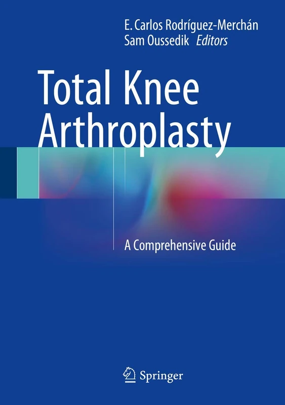 Total Knee Arthroplasty: A Comprehensive Guide