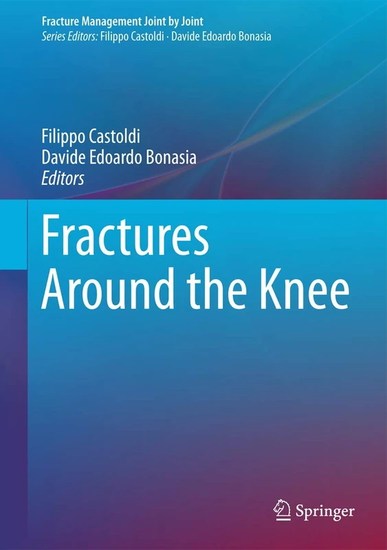 Fractures Around the Knee: 0 (Fracture Management Joint by Joint)