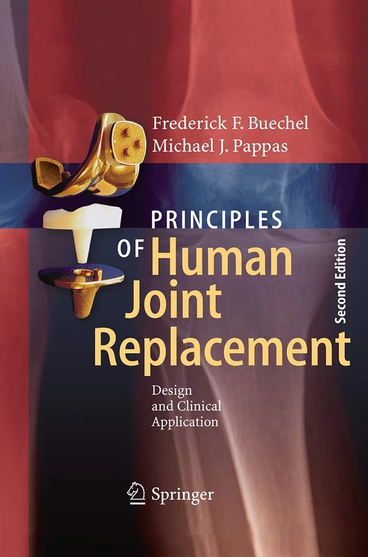 Principles of Human Joint Replacement: Design and Clinical Application