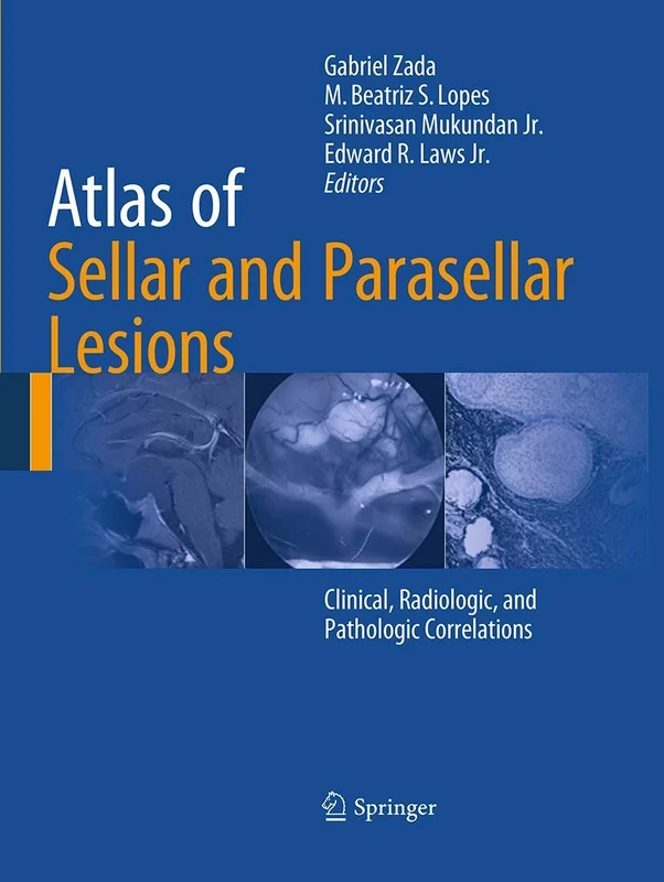 Atlas of Sellar and Parasellar Lesions: Clinical, Radiologic, and Pathologic Correlations