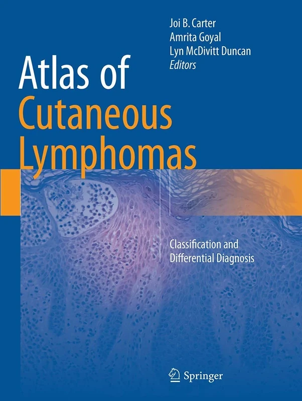 Atlas of Cutaneous Lymphomas: Classification and Differential Diagnosis