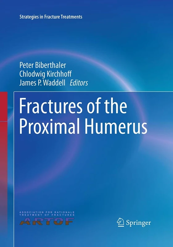 Fractures of the Proximal Humerus (Strategies in Fracture Treatments) - Image 1