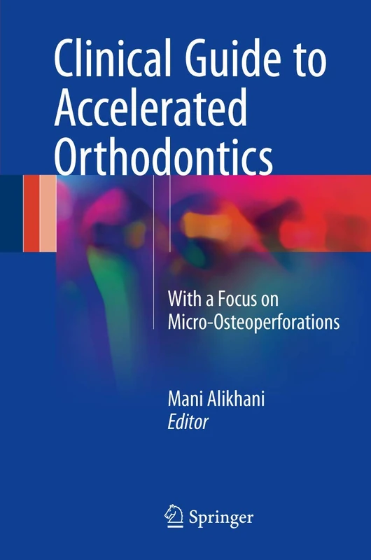 Clinical Guide to Accelerated Orthodontics: With a Focus on Micro-Osteoperforations