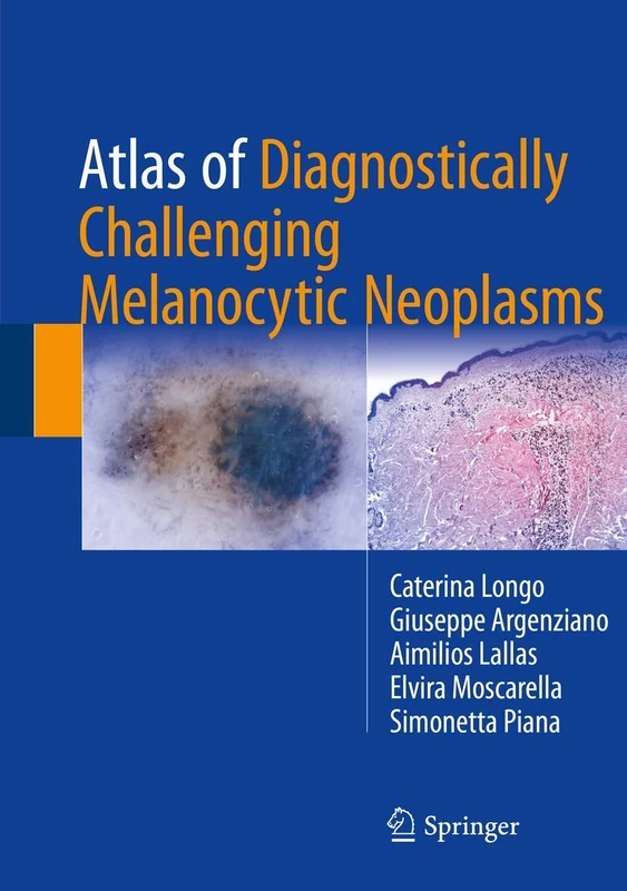 Springer Atlas of Diagnostically Challenging Melanocytic Neoplasms