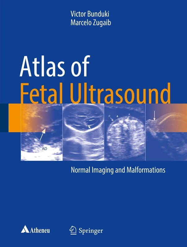 Springer Atlas of Fetal Ultrasound - Normal and Malformations