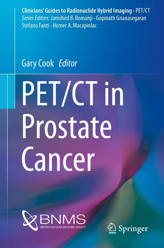 PET/CT in Prostate Cancer (Clinicians’ Guides to Radionuclide Hybrid Imaging)