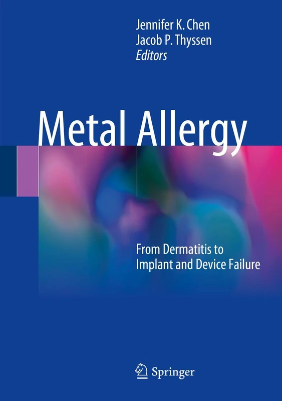 Metal Allergy: From Dermatitis to Implant and Device Failure - Image 1