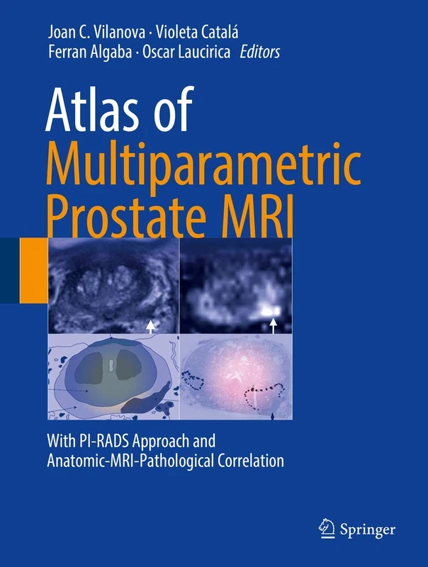 Springer Atlas of Multiparametric Prostate MRI - PI-RADS v2