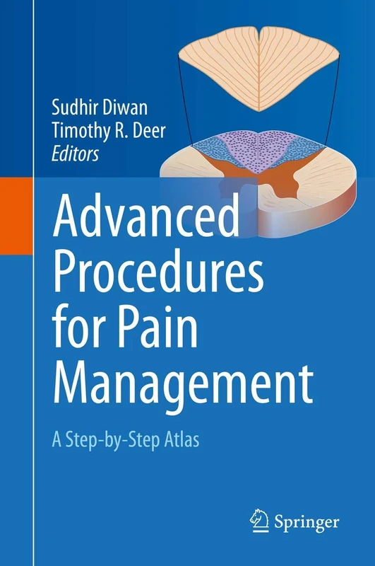 Advanced Procedures for Pain Management: A Step-by-Step Atlas