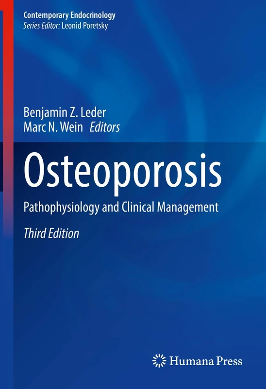 Humana Osteoporosis: Pathophysiology and Clinical Management
