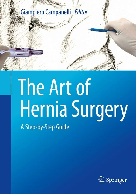 The Art of Hernia Surgery: A Step-by-Step Guide