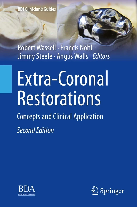 Extra-Coronal Restorations: Concepts and Clinical Application (BDJ Clinician’s Guides)