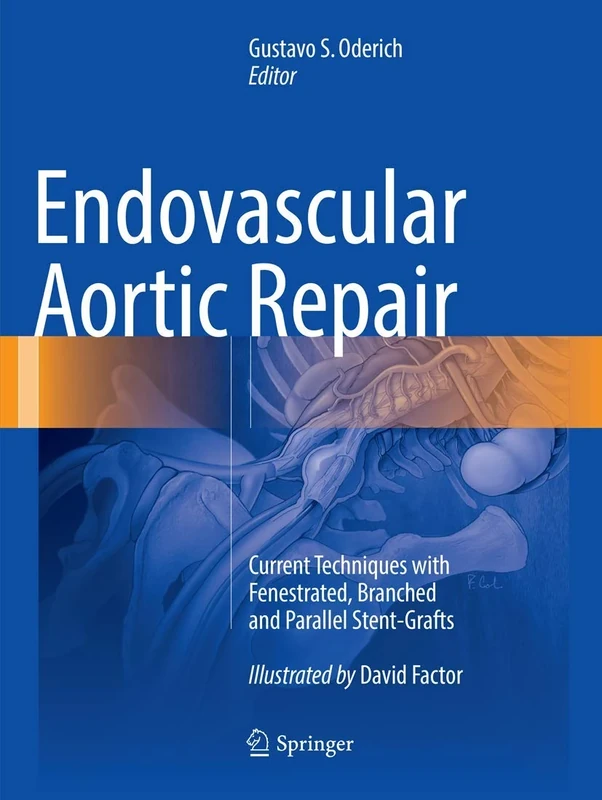 Endovascular Aortic Repair: Current Techniques with Fenestrated, Branched and Parallel Stent-Grafts