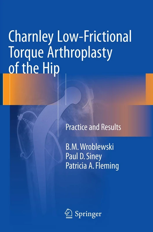Charnley Low-Frictional Torque Arthroplasty of the Hip: Practice and Results
