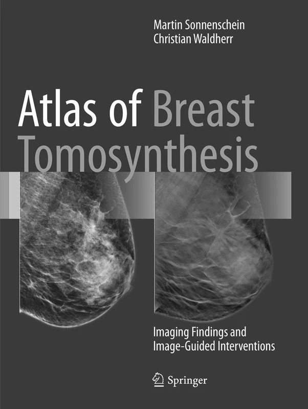 Atlas of Breast Tomosynthesis: Imaging Findings and Image-Guided Interventions