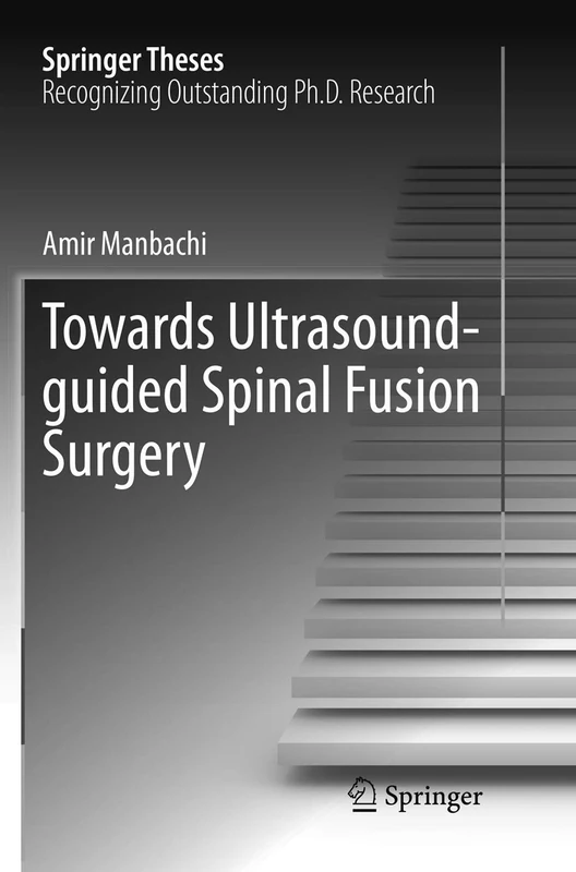 Towards Ultrasound-guided Spinal Fusion Surgery (Springer Theses)