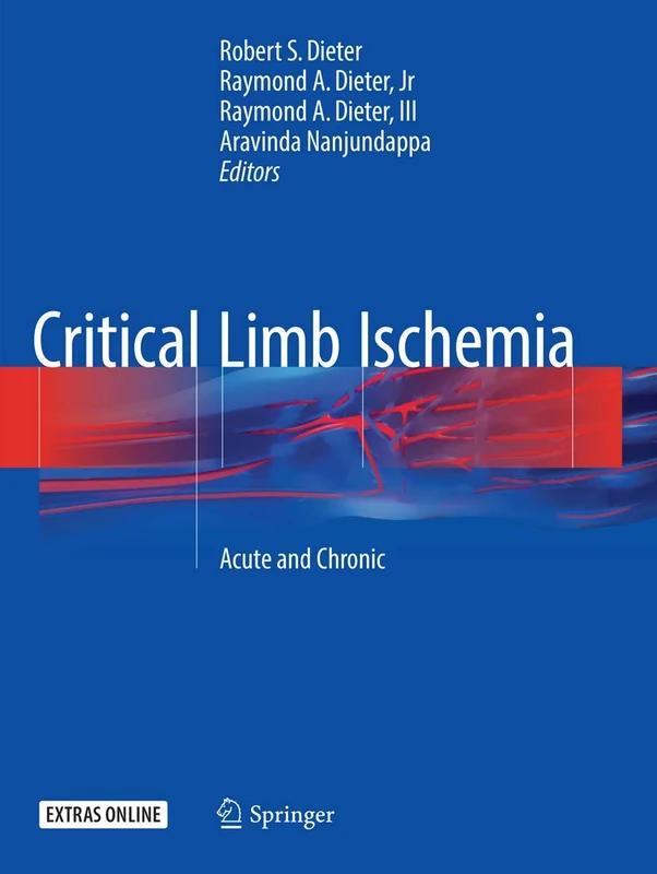 Critical Limb Ischemia: Acute and Chronic