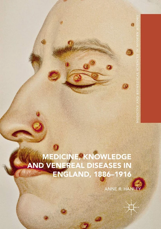 Medicine, Knowledge and Venereal Diseases in England, 1886-1916 (Medicine and Biomedical Sciences in Modern History)