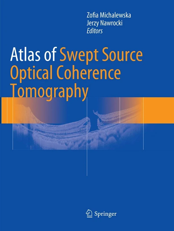 Atlas of Swept Source Optical Coherence Tomography