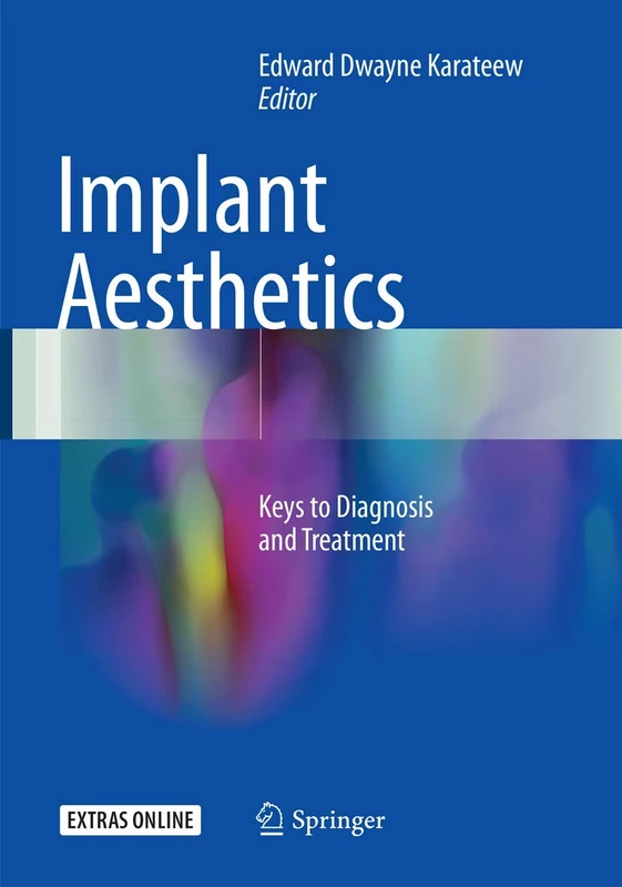 Springer - Implant Aesthetics: Keys to Diagnosis and Treatment