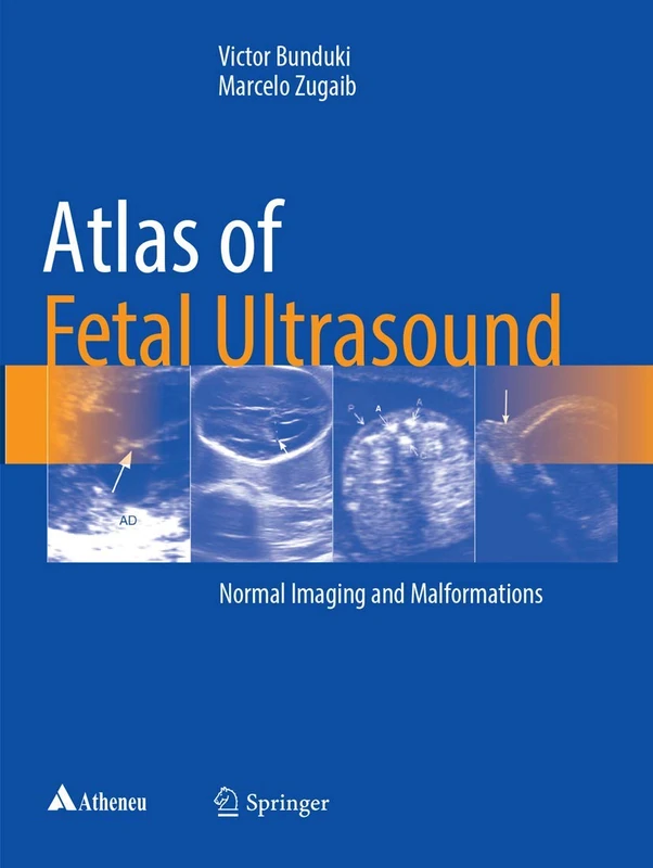 Springer Atlas of Fetal Ultrasound - Normal Imaging and Malformations