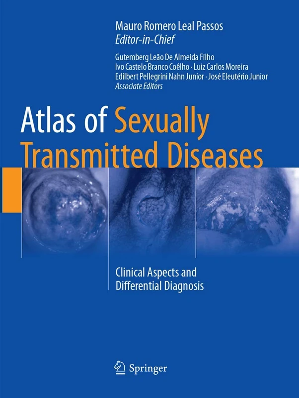 Springer Atlas of Sexually Transmitted Diseases - Medical Book