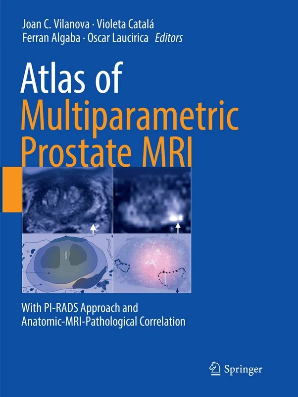 Atlas of Multiparametric Prostate MRI: With PI-RADS Approach and Anatomic-MRI-Pathological Correlation