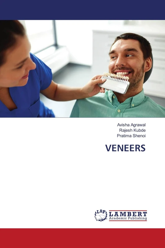 VENEERS - Image 1