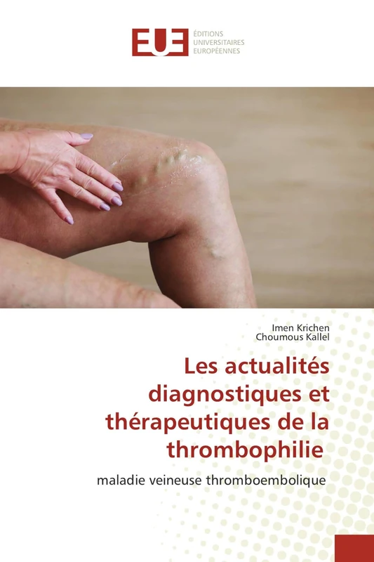 Les actualités diagnostiques et thérapeutiques de la thrombophilie: maladie veineuse thromboembolique - Image 1